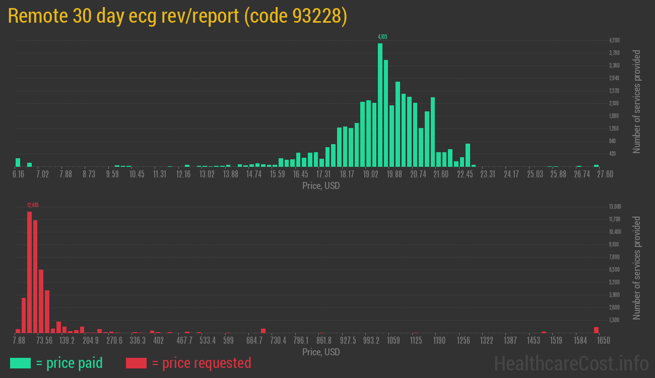 Remote 30 day ecg rev/report